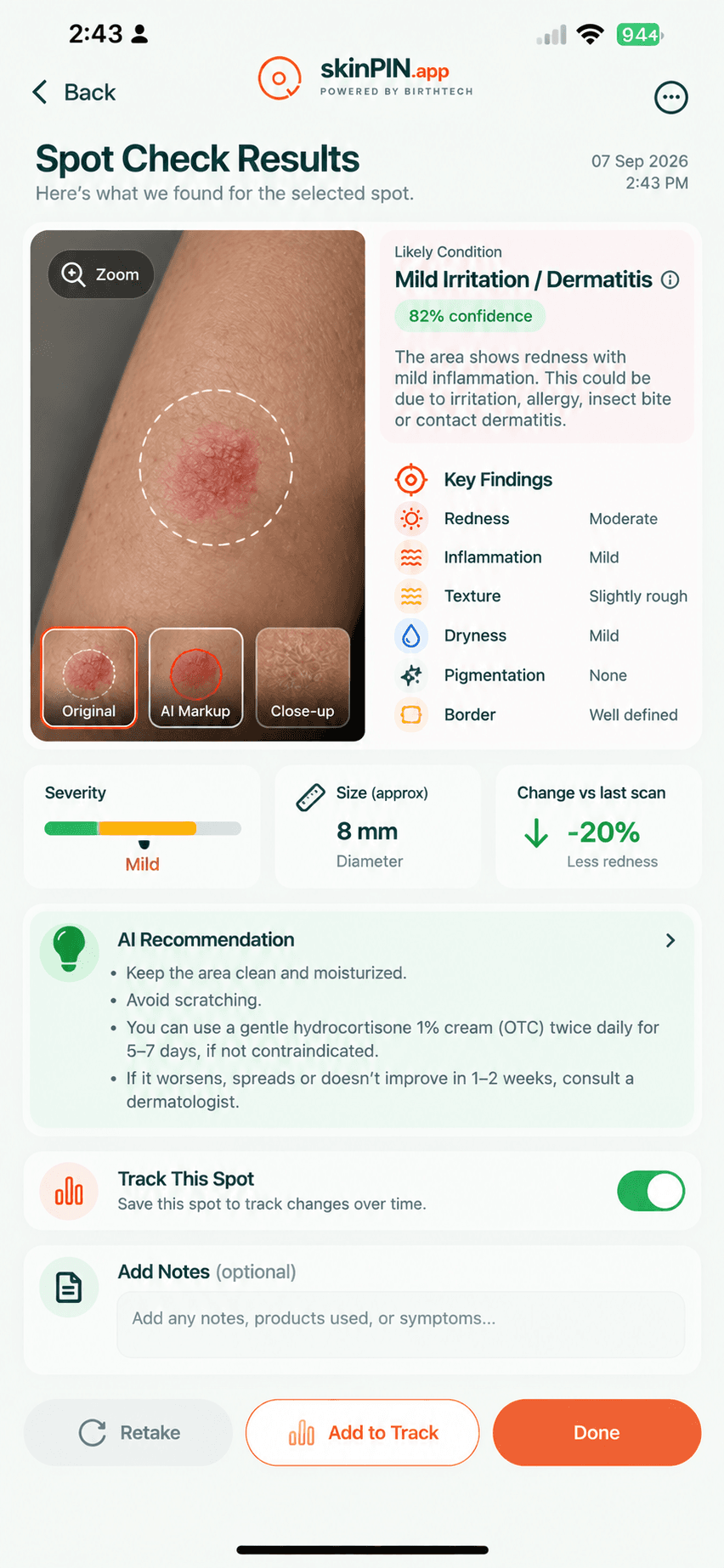 Supplied SkinPIN Spot Check interface showing a photo, example findings, tracking, and notes